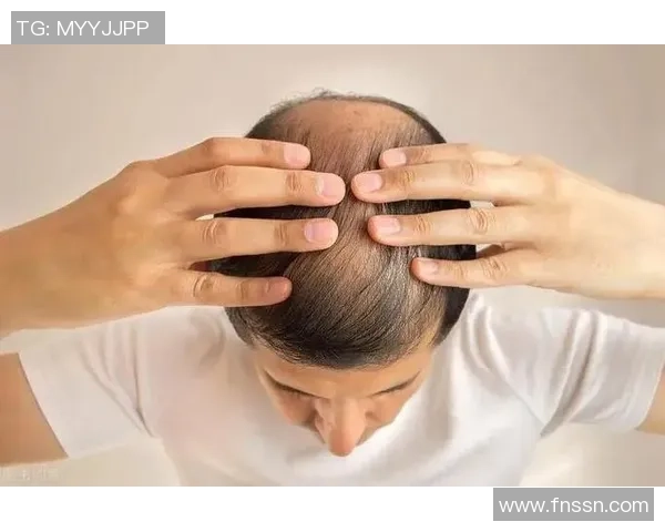 脱发困扰下的足球明星们如何应对发际线后退的烦恼与挑战